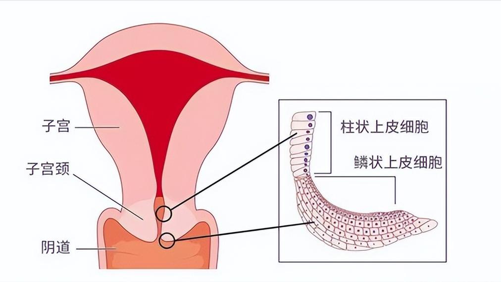 微笑面对HPV，多数感染者在两年内可自愈的奇迹之旅