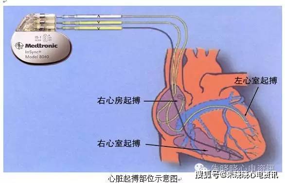 胃开启了连轴转模式，现代生活的消化挑战