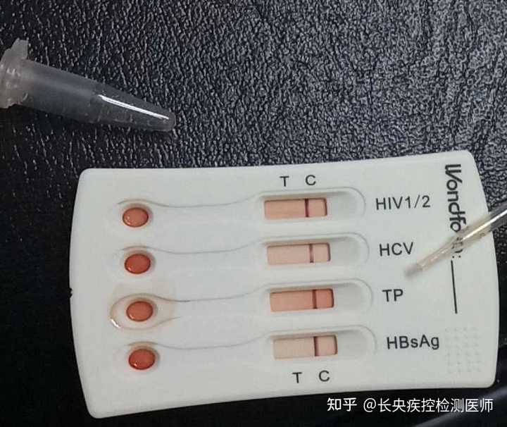 惊现HIV试纸血迹！商家回应背后隐藏的秘密